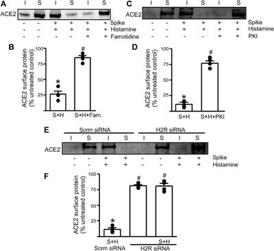 Histamine Potentiates SARS-CoV-2 Spike Protein Entry Into Endothelial Cells